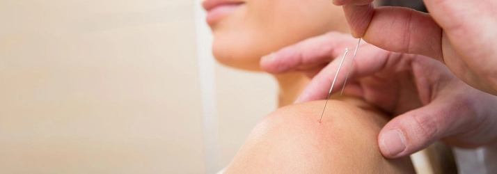 Dry Needling in Highlands Ranch CO